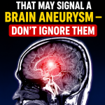12 Signs That May Signal a Brain Aneurysm — Don’t Ignore Them