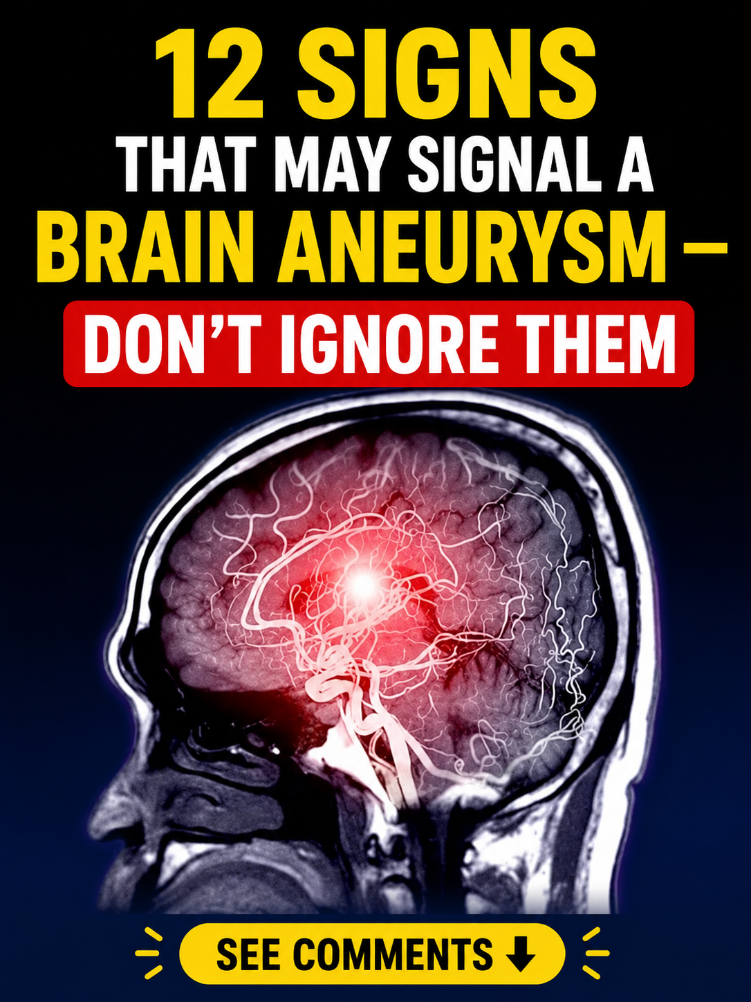 12 Signs That May Signal a Brain Aneurysm — Don’t Ignore Them