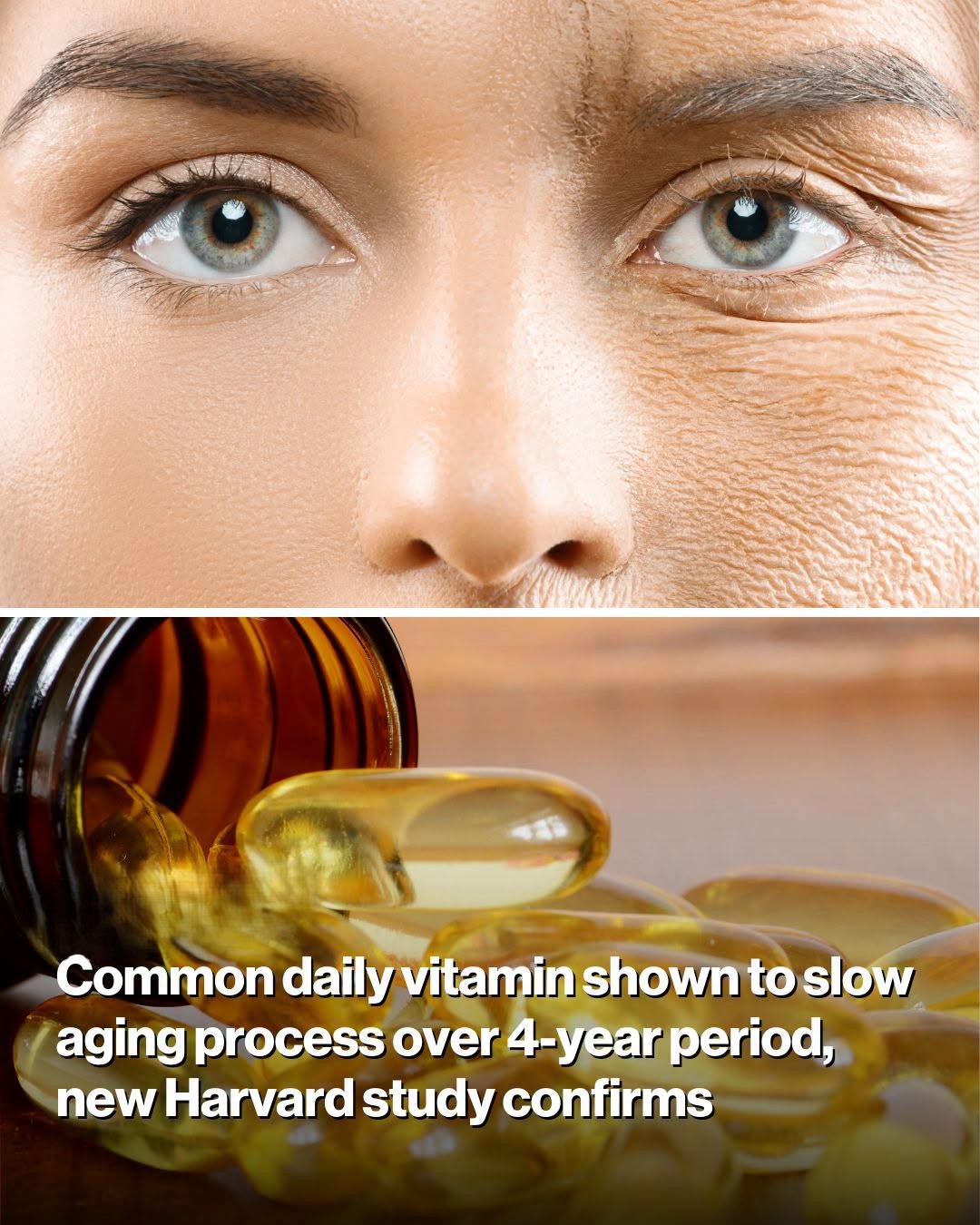 Common Daily Vitamin Shown to Slow Aging Process Over 4-Year Period, New Harvard Study Confirms