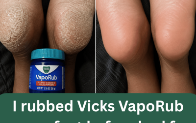 I rubbed Vicks VapoRub on my feet before bed for 10 nights. This is what happened