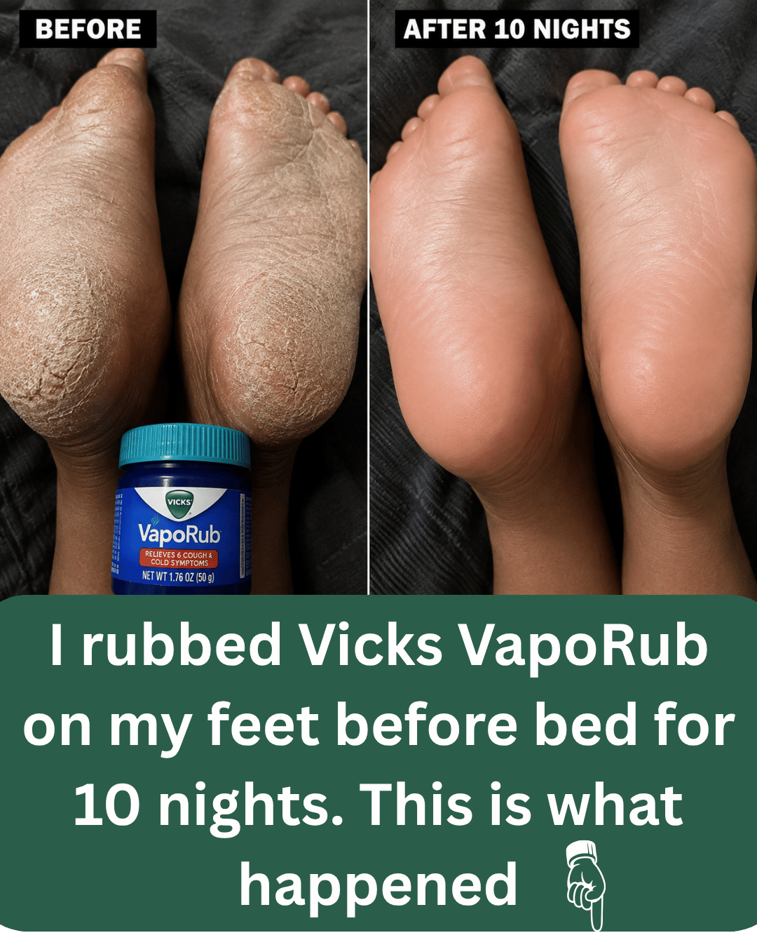 I rubbed Vicks VapoRub on my feet before bed for 10 nights. This is what happened