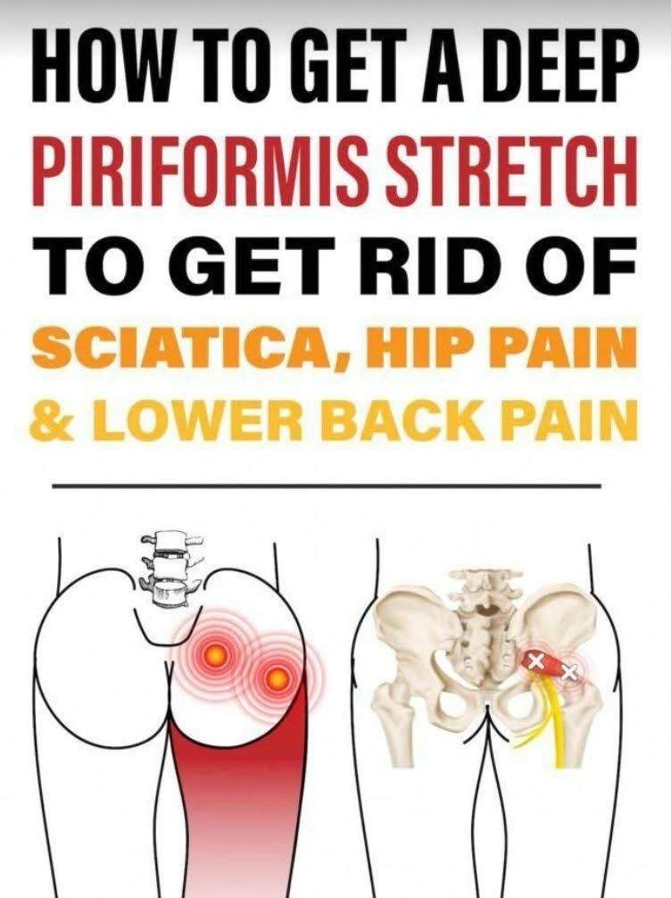 Deep Piriformis Stretch: Relieve Sciatica, Hip & Lower Back Pain